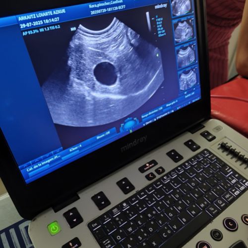 Ordenador para las ecografías