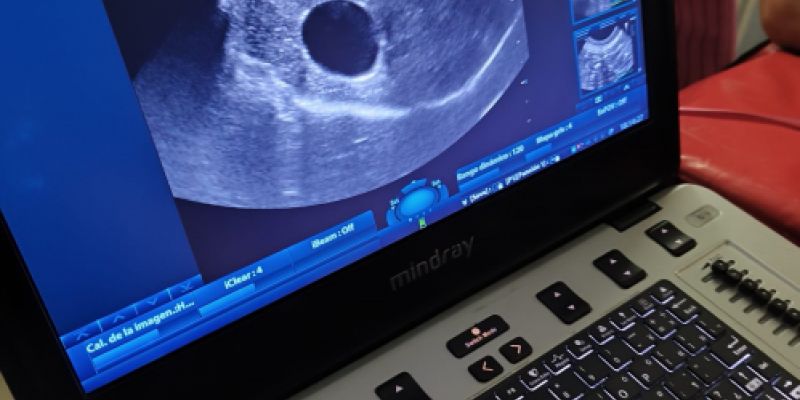Ordenador para las ecografías